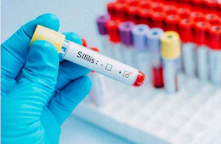 Los casos de sífilis confirmados en Entre Ríos crecieron más del 65% en el último año